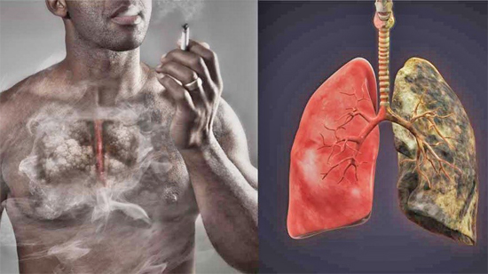 What Lungs Look Like After Smoking One Pack of Cigarettes - YogaEsoteric